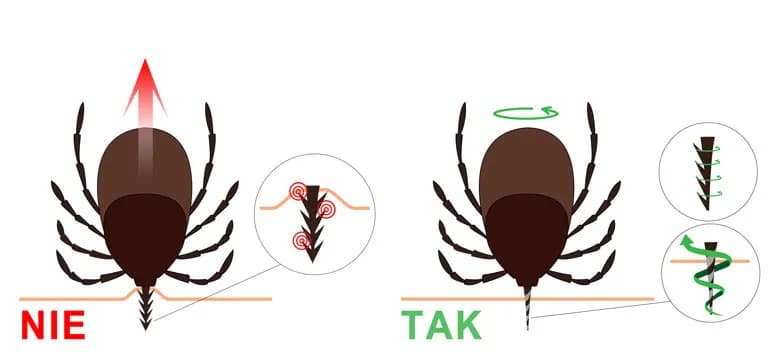 Jak bezpiecznie wyciągnąć kleszcza psu i uniknąć groźnych konsekwencji