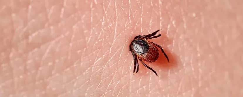 Objawy ugryzienia kleszcza – jak rozpoznać niebezpieczne sygnały