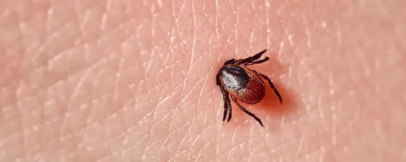 Objawy ugryzienia kleszcza – jak rozpoznać niebezpieczne sygnały