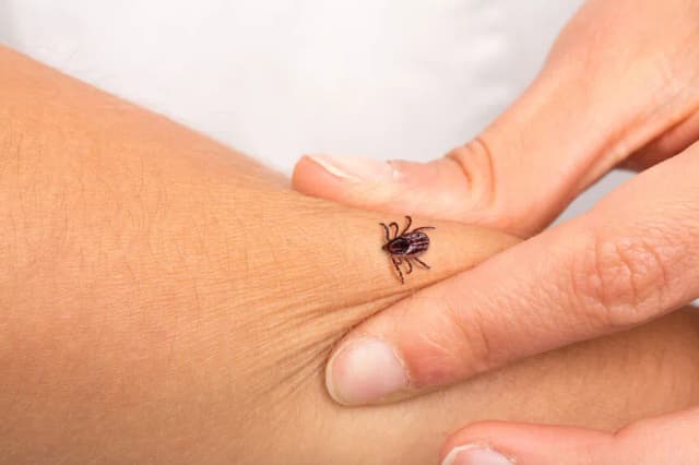 Kleszcze u dzieci objawy: Jak rozpoznać niebezpieczne symptomy