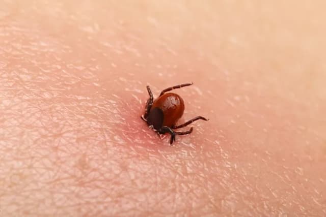 Objawy kleszczowego zapalenia opon mózgowych - nie przegap ich!